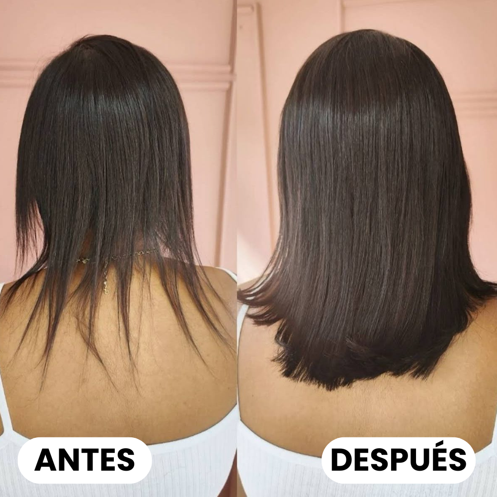 Remimpi Anti-Caída
